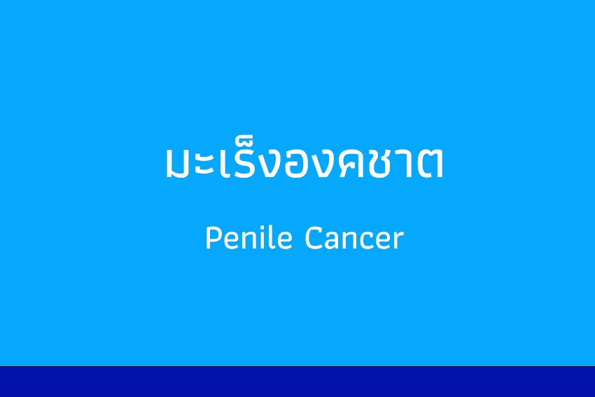 มะเร็งองคชาต สถานวิทยามะเร็งศิริราช คณะแพทยศาสตร์ศิริราชพยาบาล มหาวิทยาลัยมหิดล