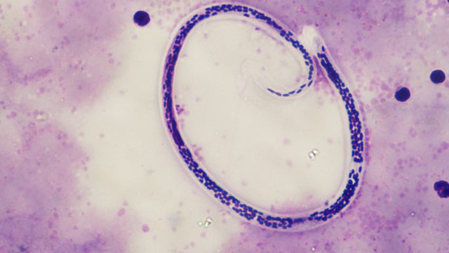 Parasitology – About