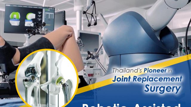 Siriraj – the first hub of robotic assisted joint replacement