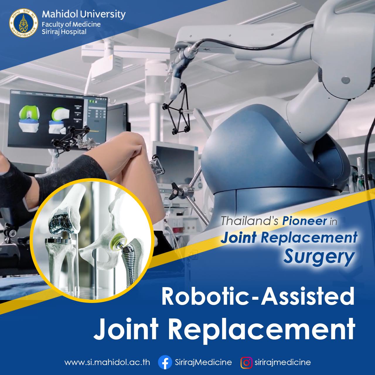Siriraj – the first hub of robotic assisted joint replacement