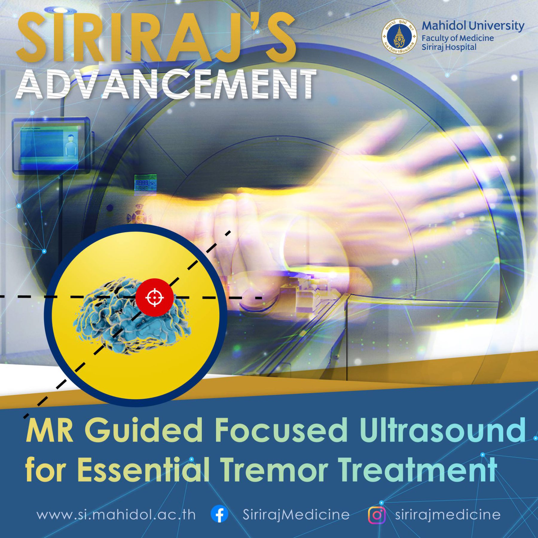 MRI-guided Focused Ultrasound (MRgFUS) The advancement in radiology that faculty of medicine Siriraj hospital
