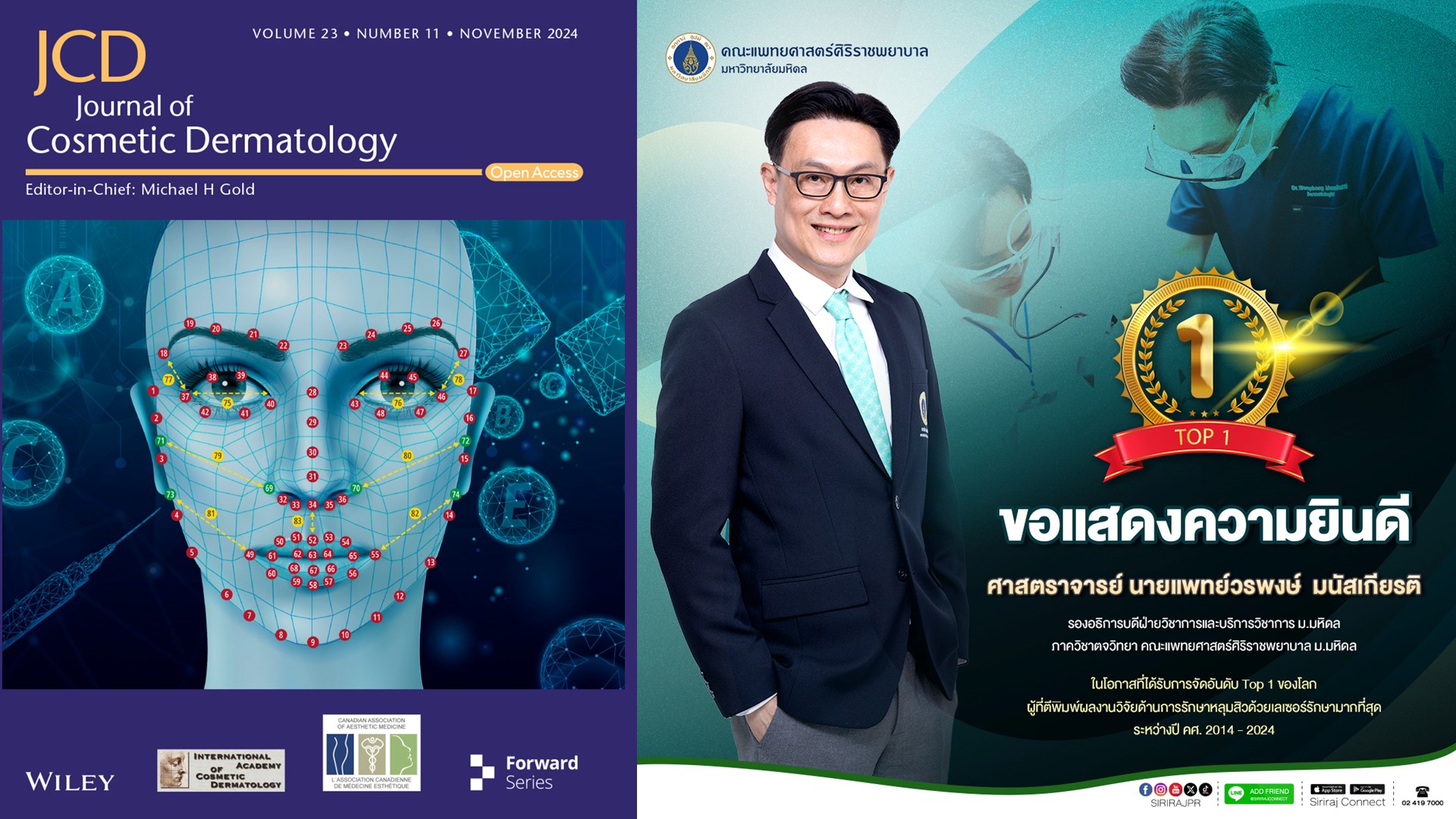 Siriraj Professor Recognized as World’s Leading Author on Laser Treatment for Acne Scars (2014–2024)