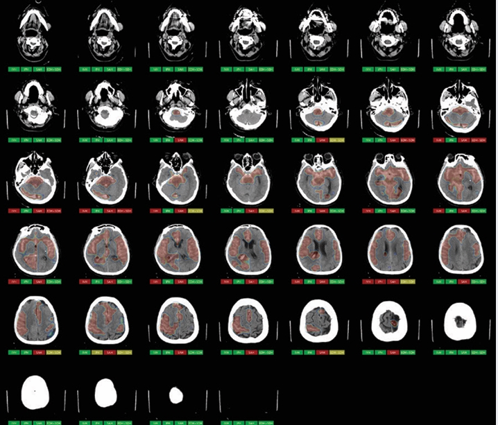 AI BRAIN
